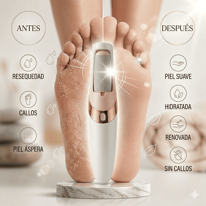 Limador de Callos Eléctrico – Resultados Profesionales en Casa